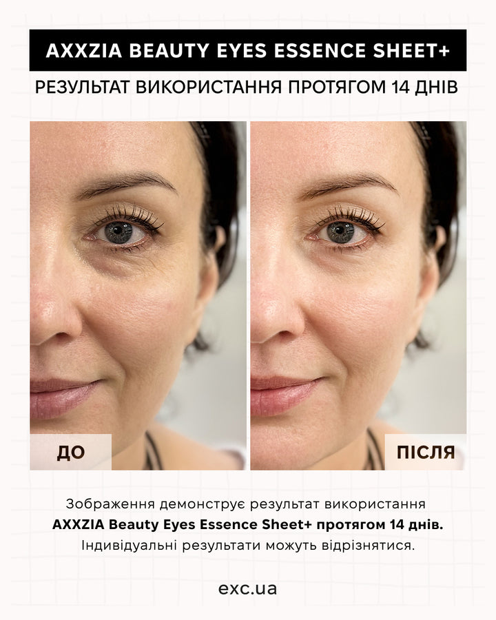 Патчі AXXZIA Beauty Eyes Essence Sheet PLUS- EXC.UA 