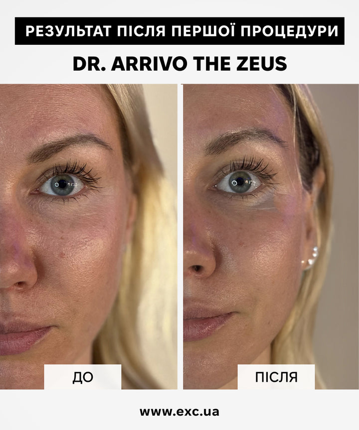 Косметичні апарати Dr. Arrivo Zeus II- EXC.UA 