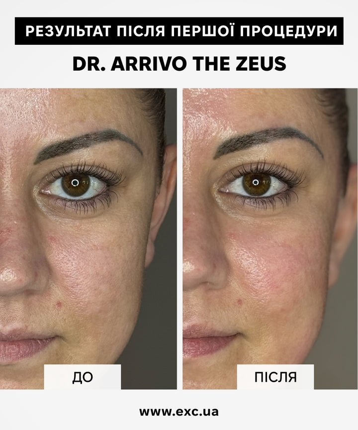 Косметичні апарати Dr. Arrivo Zeus II PLus (Black)- EXC.UA 