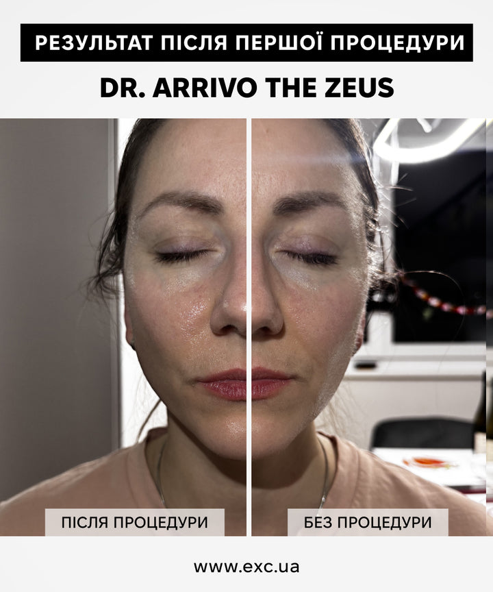 Апаратний догляд Dr. Arrivo Zeus IV- EXC.UA 