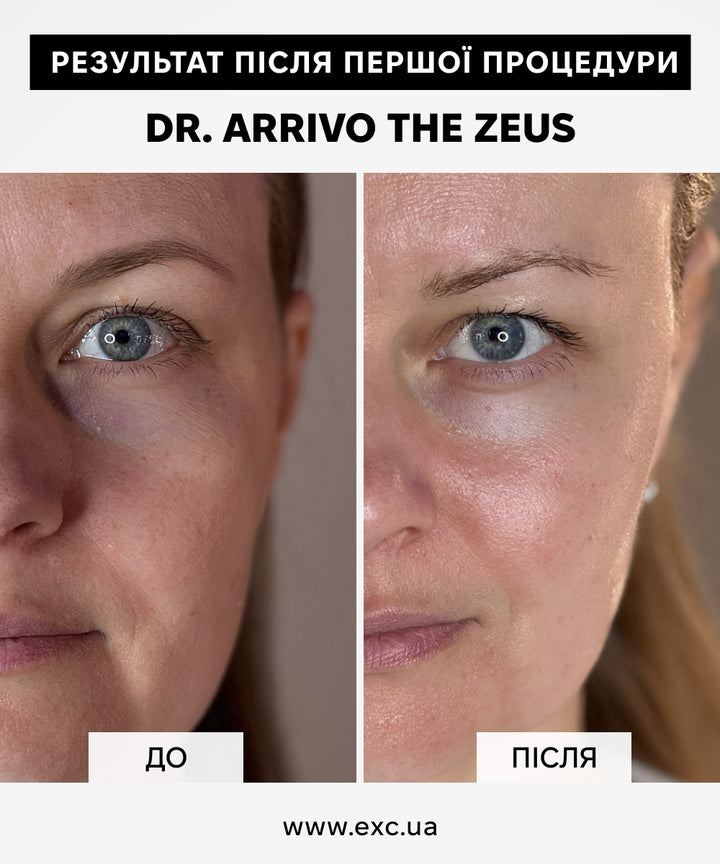 Апаратний догляд Dr. Arrivo Zeus IV- EXC.UA 