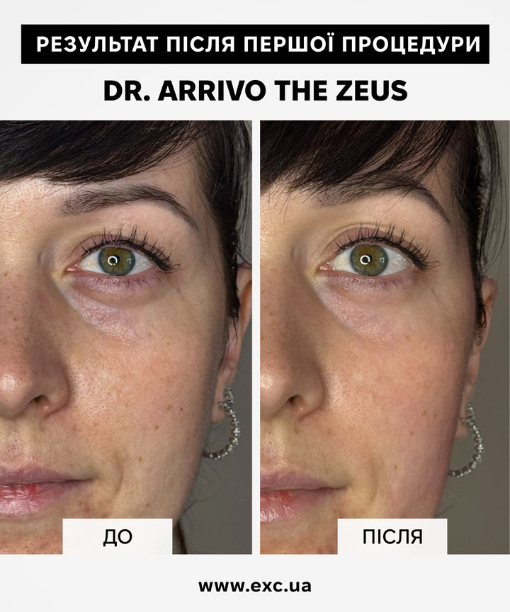 Апаратний догляд Dr. Arrivo Zeus IV- EXC.UA 