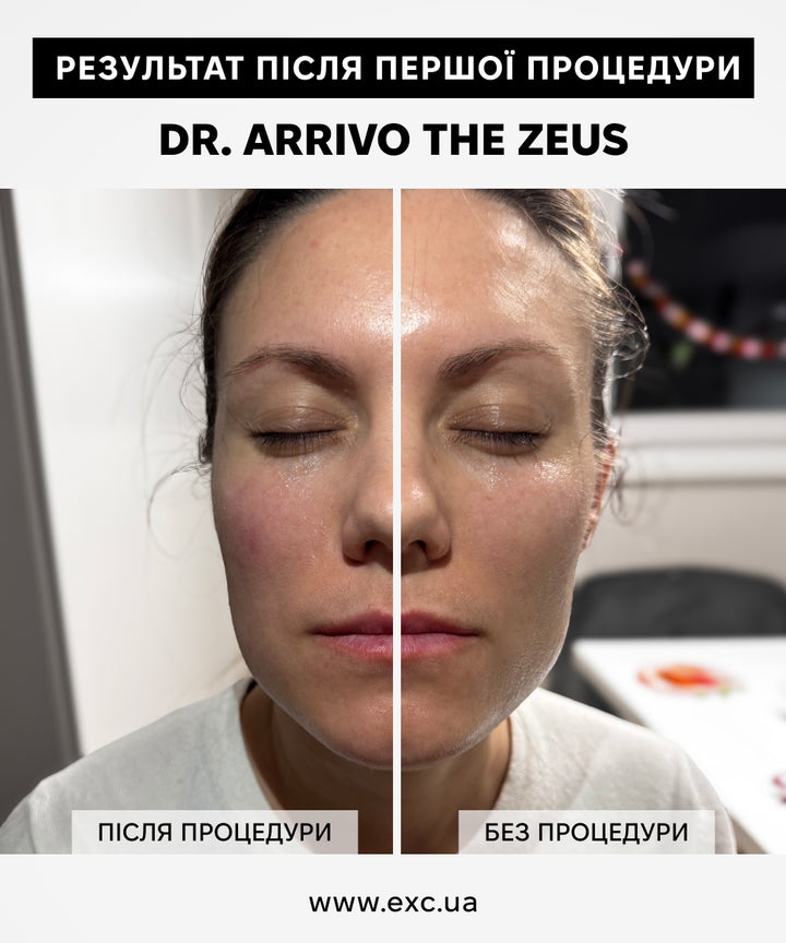 Косметичні апарати Dr. Arrivo Zeus II- EXC.UA 