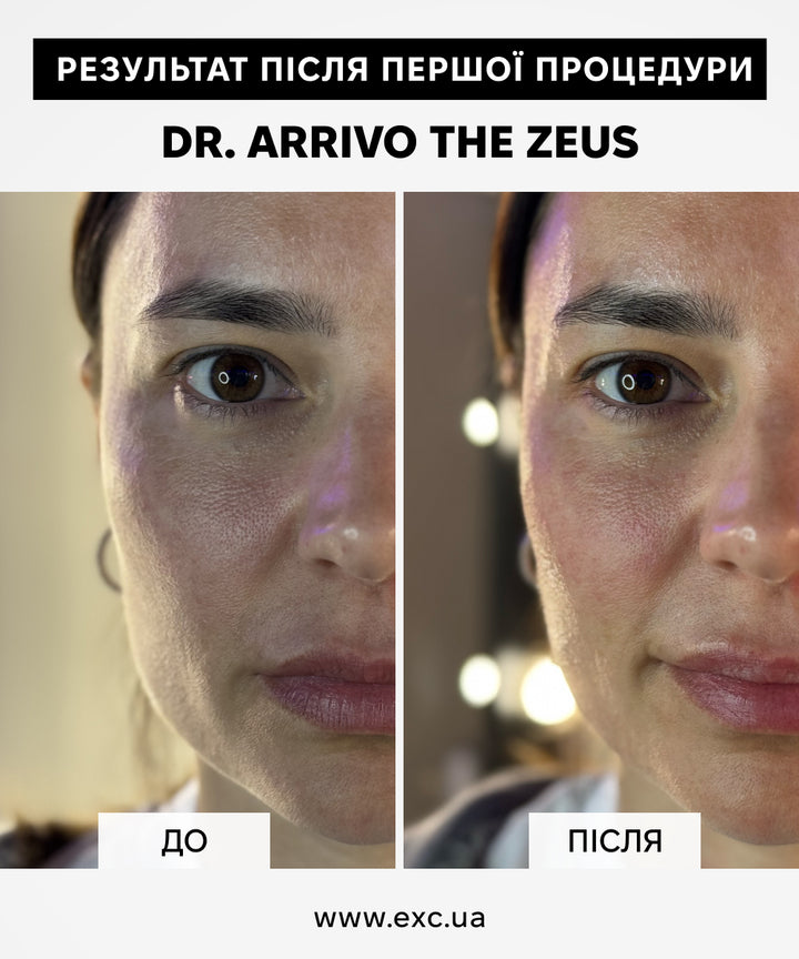 Косметичні апарати Dr. Arrivo Zeus II- EXC.UA 