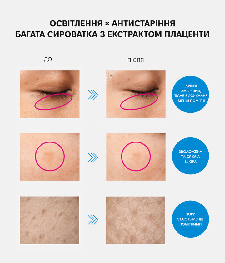 Лосьйон Meishoku Medicated Placenta Whitening Essence- EXC.UA 