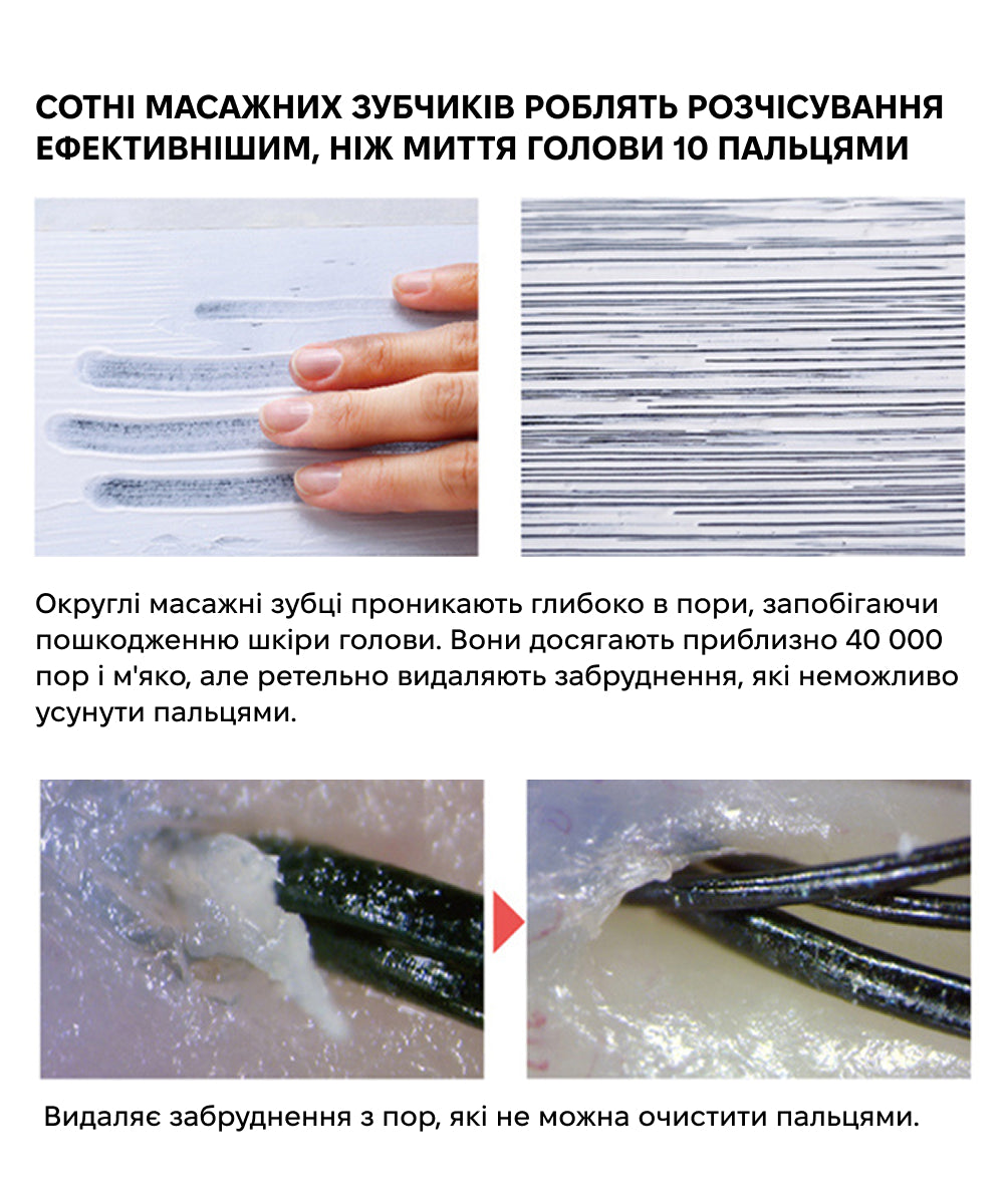 S-HEART-S Scalp Brush World Premium Short Champagne Gold — Щетка