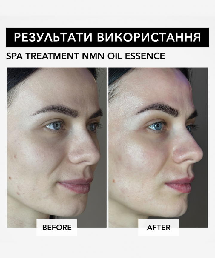 Есенція Spa Treatment NMN Oil Essence- EXC.UA 