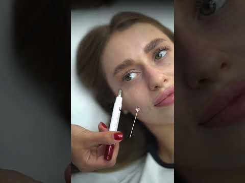 Spa Treatment Loose Spicule - Сироватка з мікроспікулами для