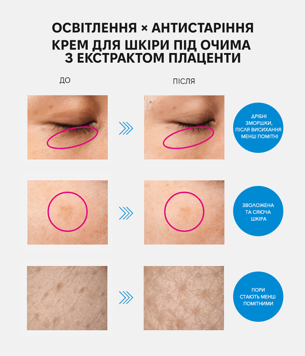 Meishoku Medicated Placenta Whitening Eye Cream - Крем для шкіри під очима