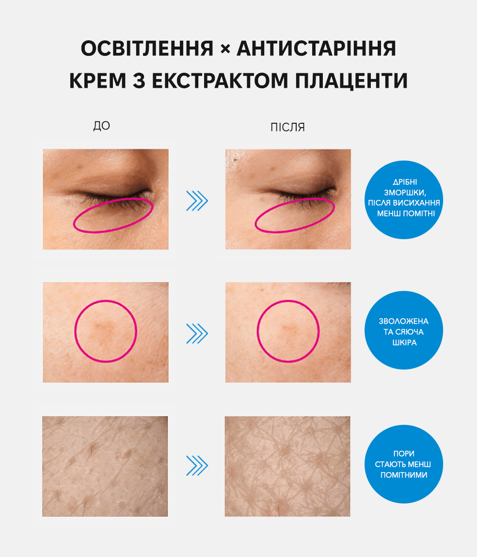 Meishoku Medicated Placenta Whitening cream - Крем проти пігментних плям